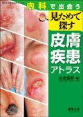内科で出会う見ためで探す皮膚疾患アトラス
