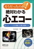 そうだったのか!絶対わかる心エコー