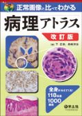 正常画像と比べてわかる 病理アトラス 改訂版