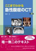 ここまでわかる急性腹症のCT 第3版