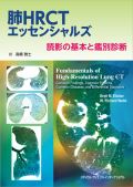 肺HRCTエッセンシャルズ
