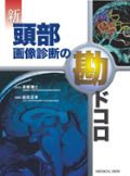 新 頭部画像診断の勘ドコロ