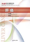 がん研スタイル 肝癌