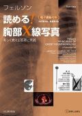 フェルソン 読める!胸部X線写真 改訂第3版/原著第4版