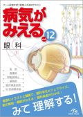 病気がみえる Vol.12 眼科