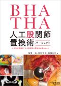 BHA・THA人工股関節置換術パーフェクト