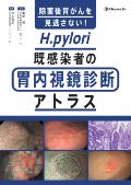 除菌後胃がんを見逃さない!H.pylori既感染者の胃内視鏡診断アトラス
