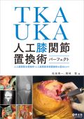 TKA UKA 人工膝関節置換術パーフェクト