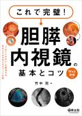 これで完璧!胆膵内視鏡の基本とコツ