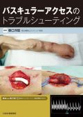 バスキュラーアクセスのトラブルシューティング